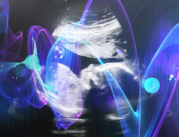 Baby sonogram with music waves