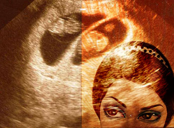 Twin ultrasound with superimposed drawing of young woman's eyes